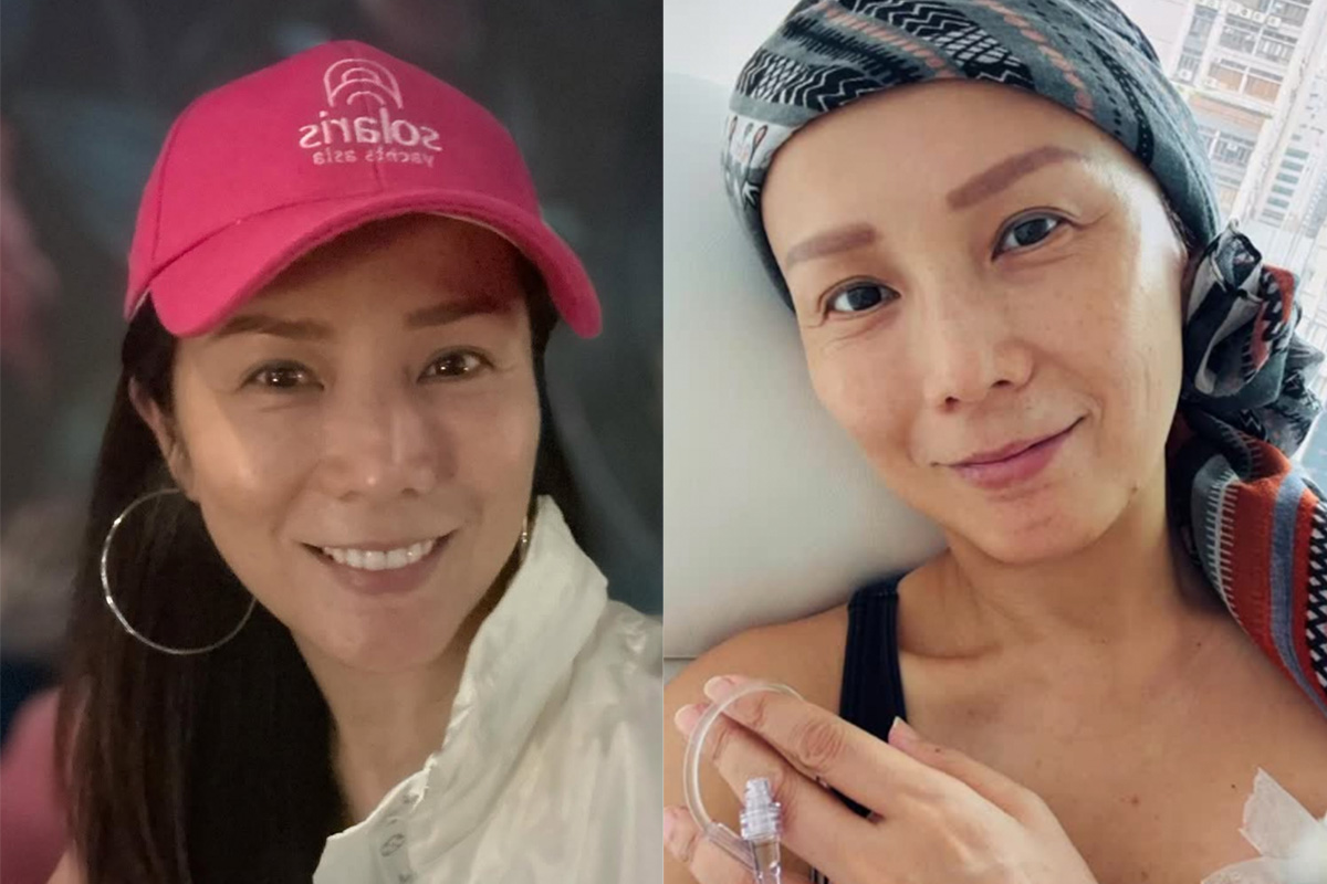 51歲女星乳癌惡化擴散淋巴　病情急轉至4期曝治療現況