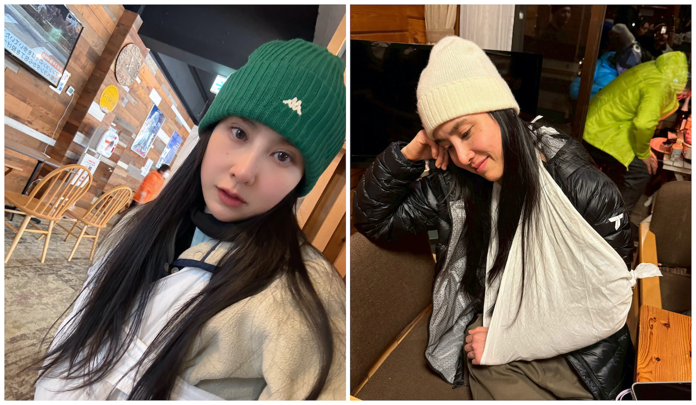 房子去年因滑雪意外造成手臂脫臼重傷。(圖/房思瑜提供)