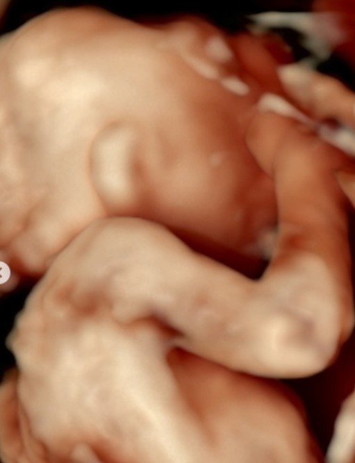 焦凡凡喜曬寶寶超音波照。(圖/焦凡凡IG)