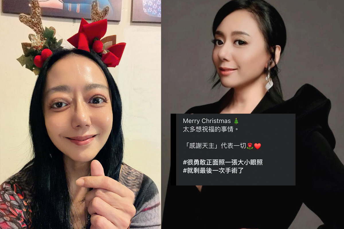 高慧君甲狀腺眼疾險失明。(圖/高慧君FB)