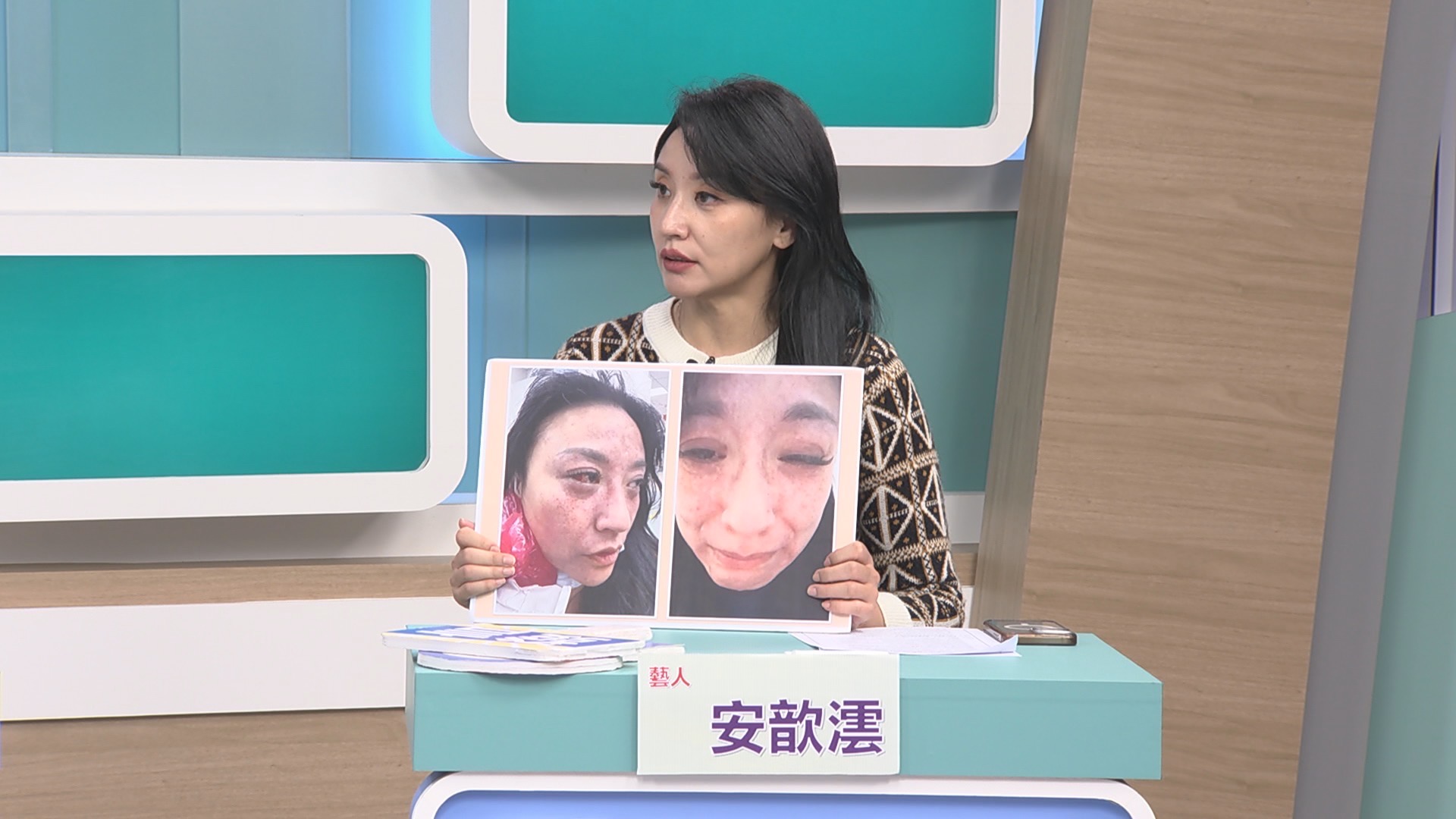 安歆澐節目曝光遭施暴照片。（圖／高點提供）