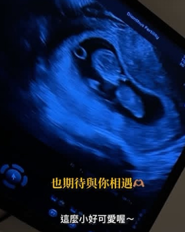 Ivy宣布懷孕。（圖／翻攝自IG）