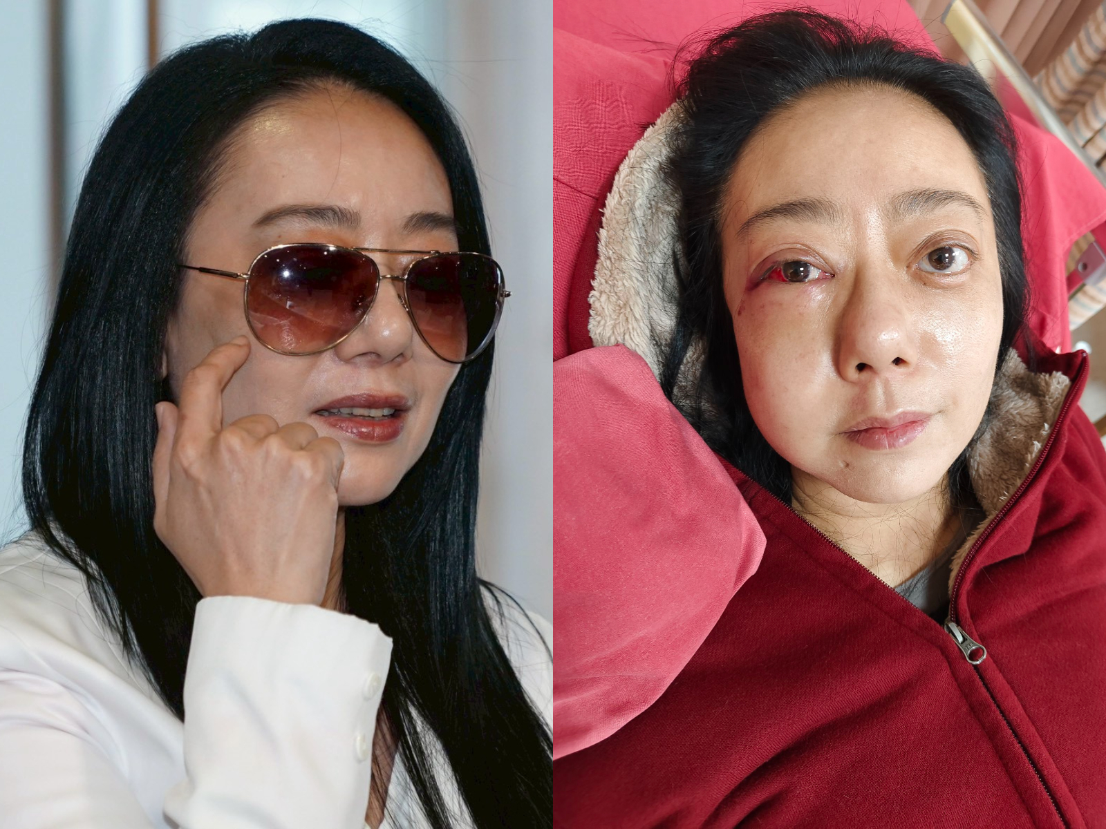 高慧君當初跌倒很嚴重。（圖／娛樂中心攝、經紀人提供）