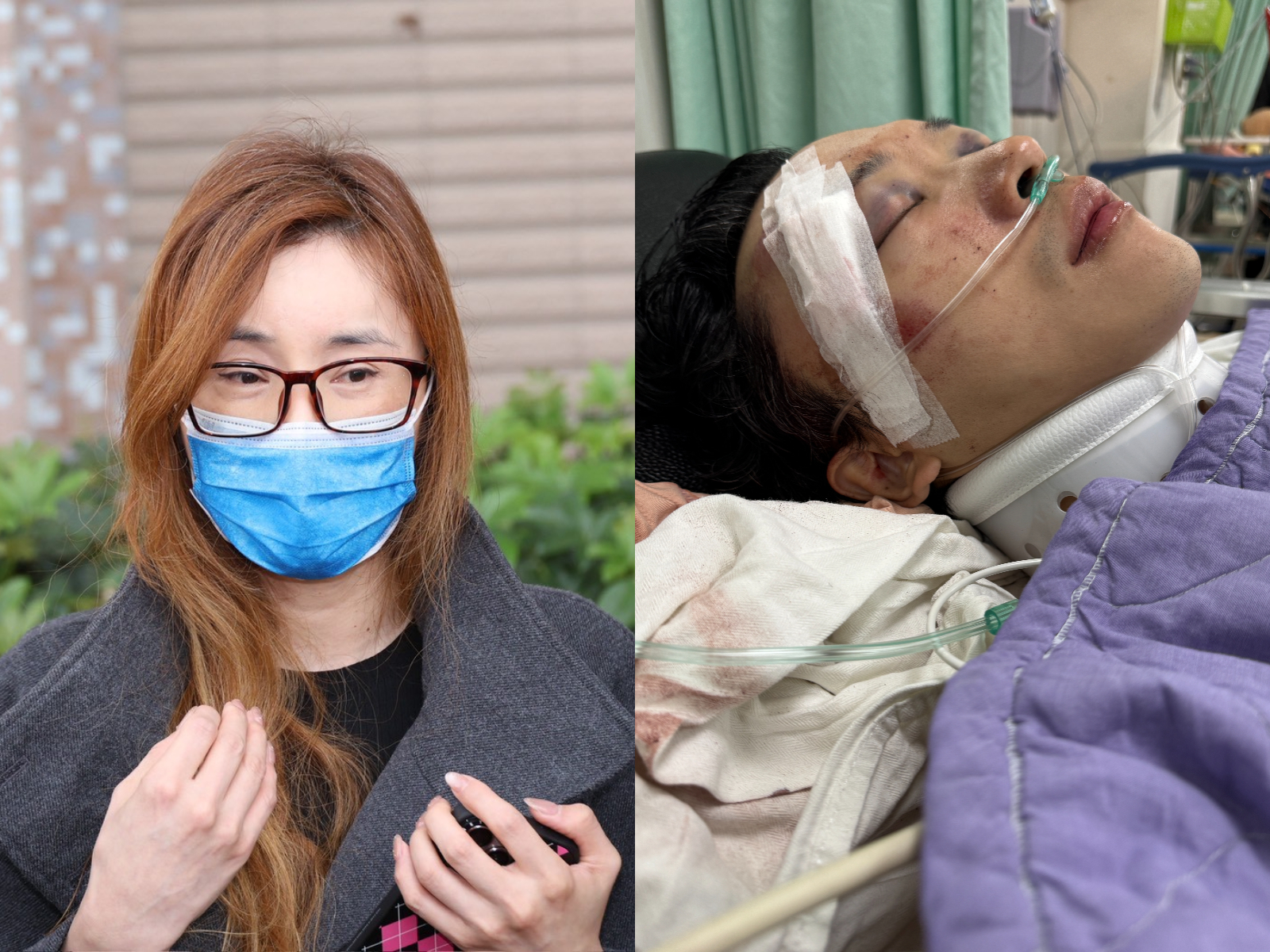 Rena（左圖）公布蘇先生受傷照（右圖）。（圖／娛樂中心攝、未婚妻提供）