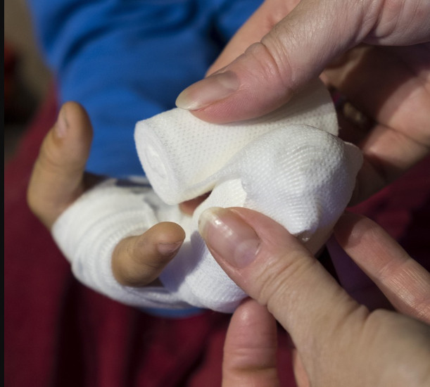 一般人都以為，傷口結痂代表快好，但醫師打臉了。（示意圖／翻攝自pixabay）