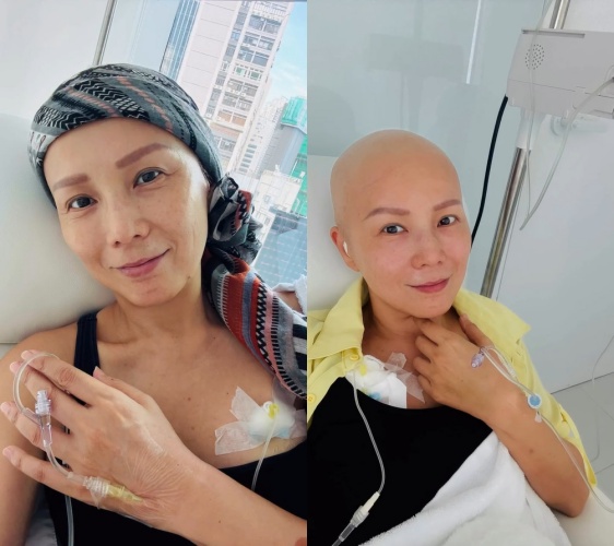 前港姐吳文忻罹患乳癌，積極抗癌中。（圖／翻攝自吳文忻IG）