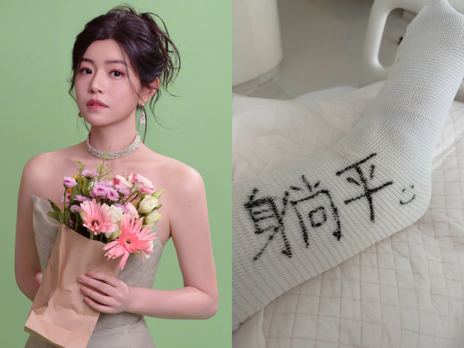 陳妍希腳又受傷了。(圖/翻攝陳妍希微博)