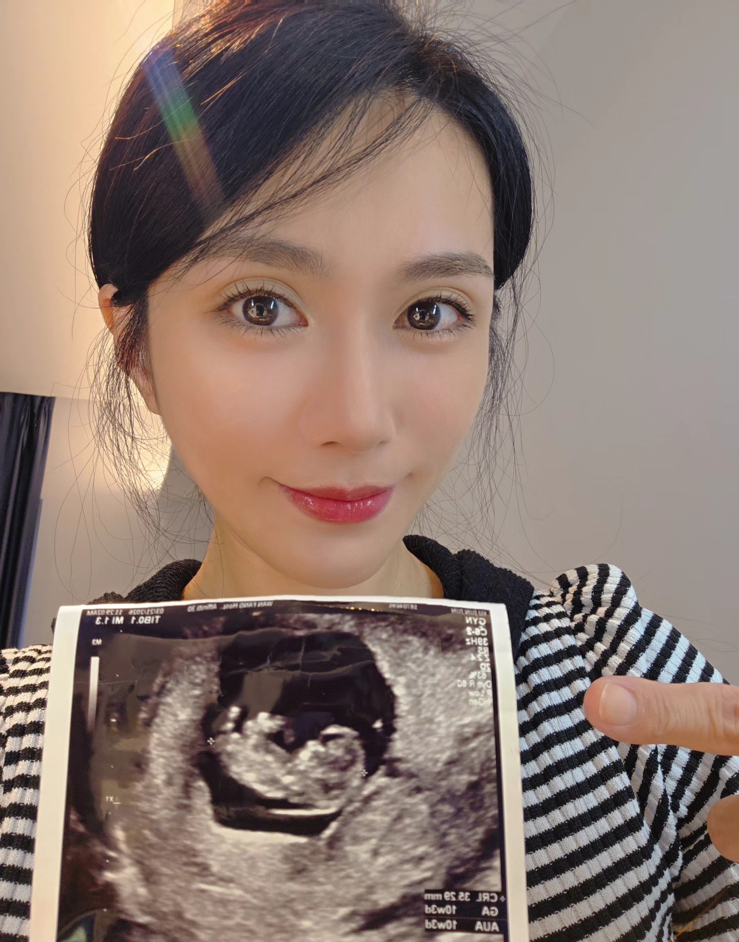 許鈞鈞曬出超音波照片。（圖／翻攝自許鈞鈞Chun臉書）