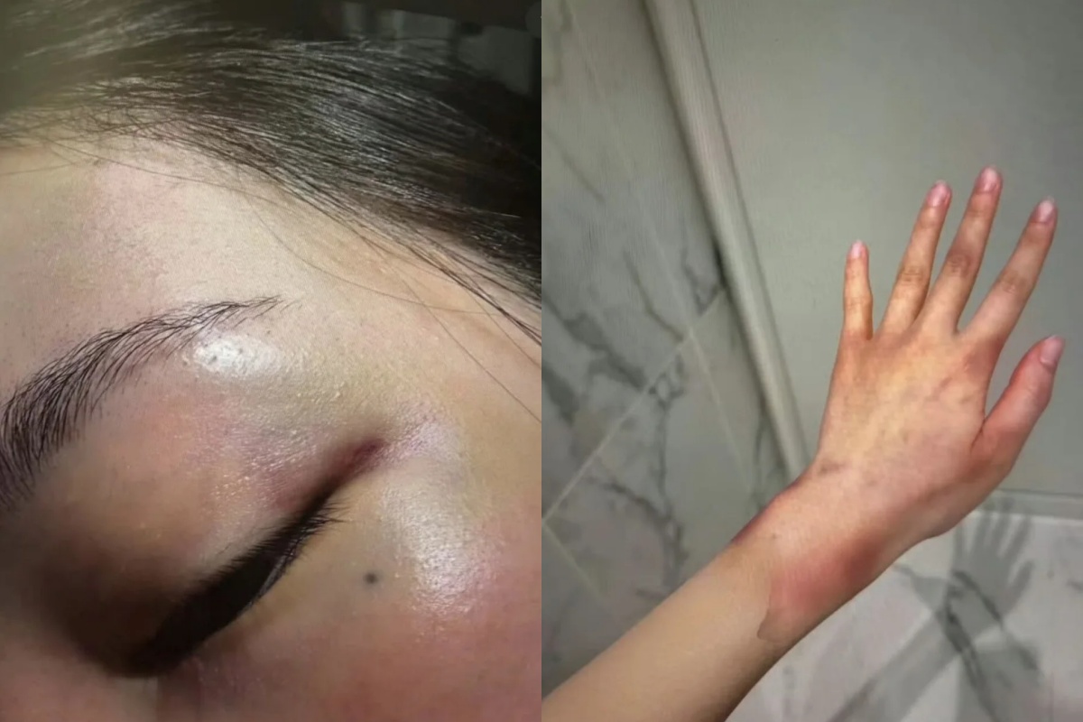 疑似Jisoo大嫂在網路公開家暴照。（圖／翻攝自網路）