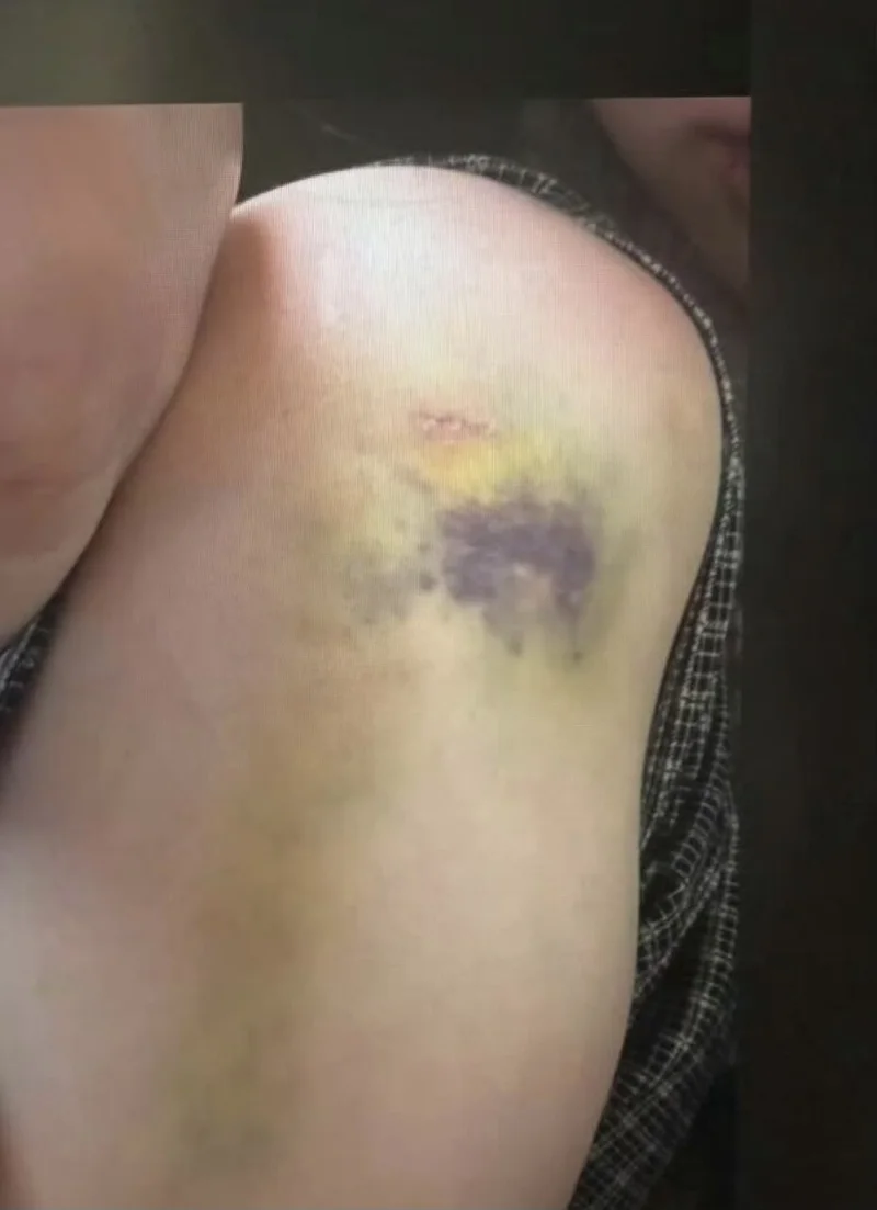 疑似Jisoo大嫂在網路公開家暴照。（圖／翻攝自網路）