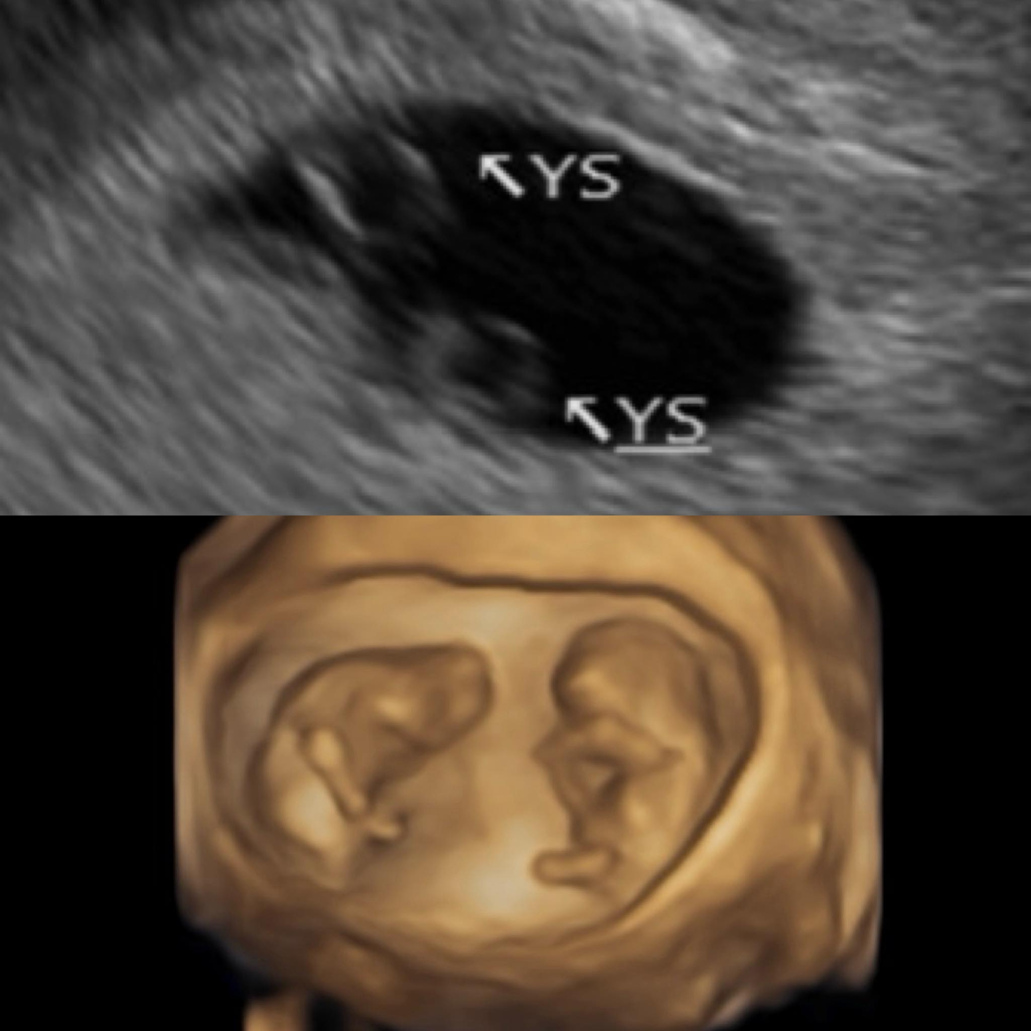 鄭家純目前已懷孕12週。（圖／翻攝自鄭家純臉書）