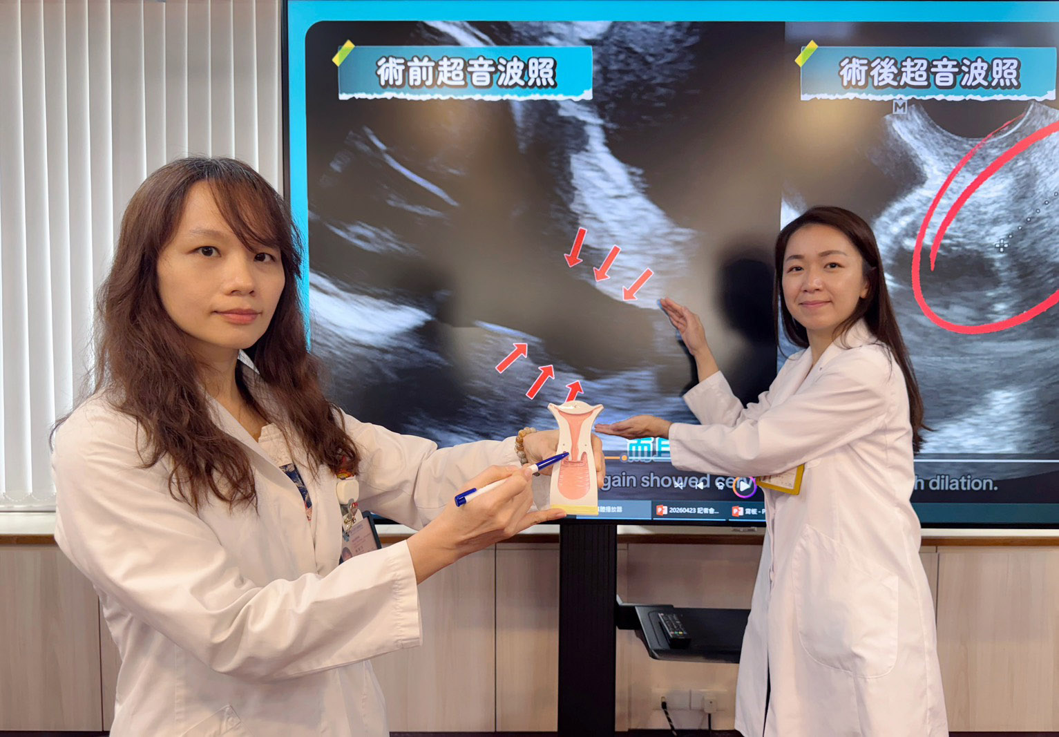 臺中榮總婦女醫學部高危險妊娠科主任陳雅芳(左)指出子宮頸縮短及擴張位置；醫師林俐伶(右)說明，丁小姐子宮頸擴張情形透過超音波檢查清楚可見。（圖／臺中榮總提供）