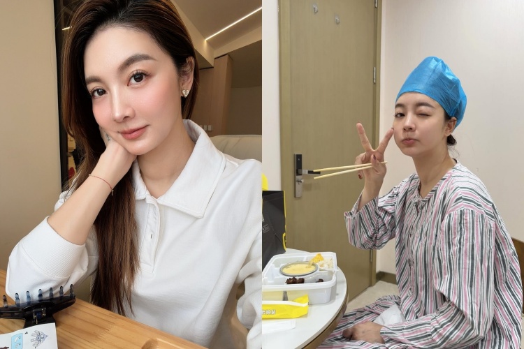 吳亞馨自爆罹患妊娠糖尿病，更有掉髮的困擾，讓她決定去植髮。（圖／翻攝自吳亞馨IG）