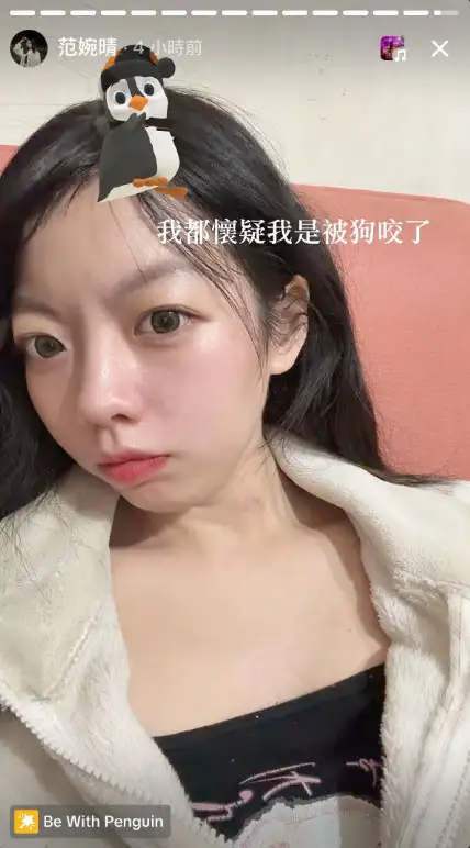 婉晴的頸部有紅印。（圖／翻攝自Threads）