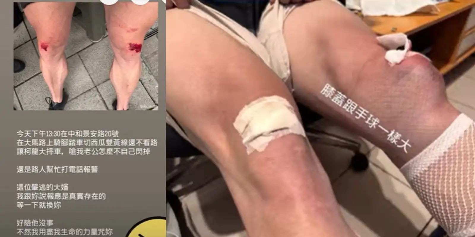 柯龍遭騎士「鬼切」撞到摔車傷勢曝。（圖／翻攝Instagram）