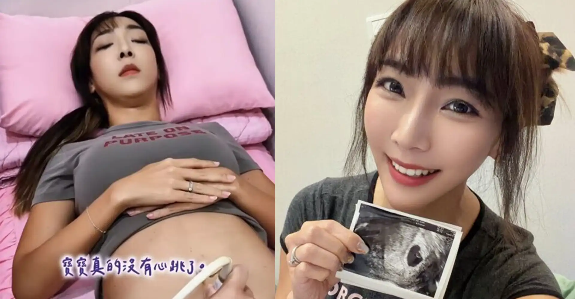 42歲李宓懷六寶證實流產。(圖/翻攝FB)