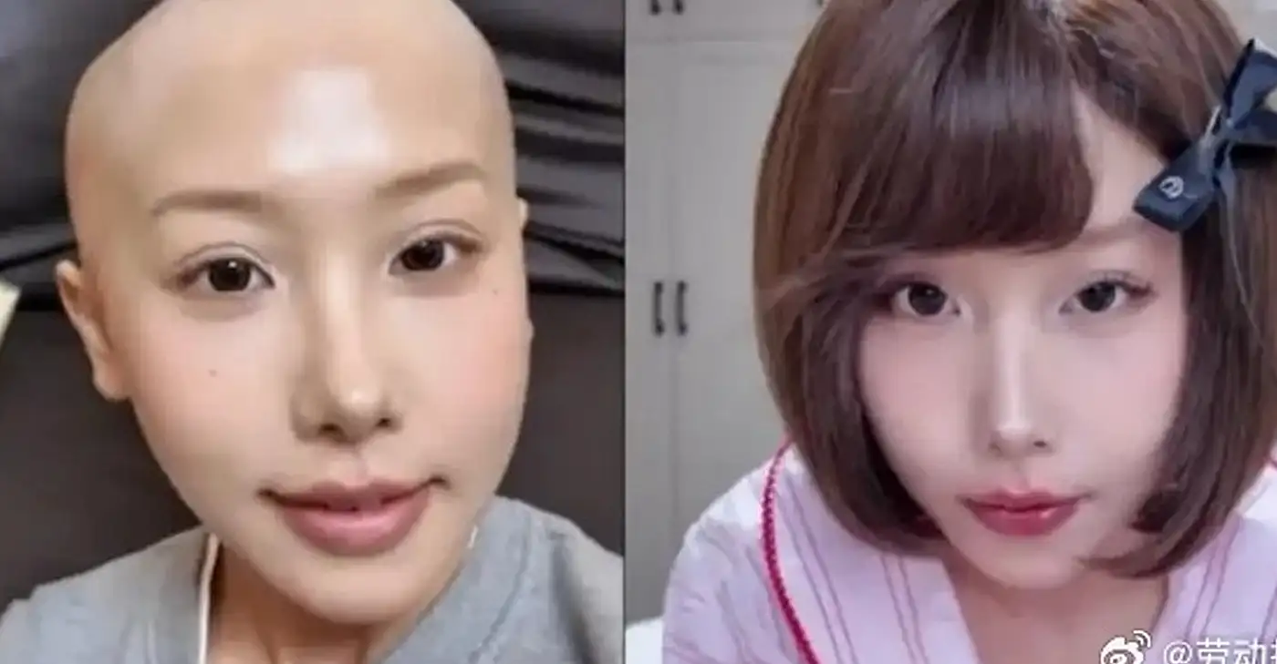 嘻嘻徐寶胃癌過世得年26歲。(圖/翻攝微博)